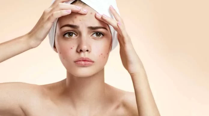 12 Most Annoying Beauty Problems All Women Face and How To Fix Them
